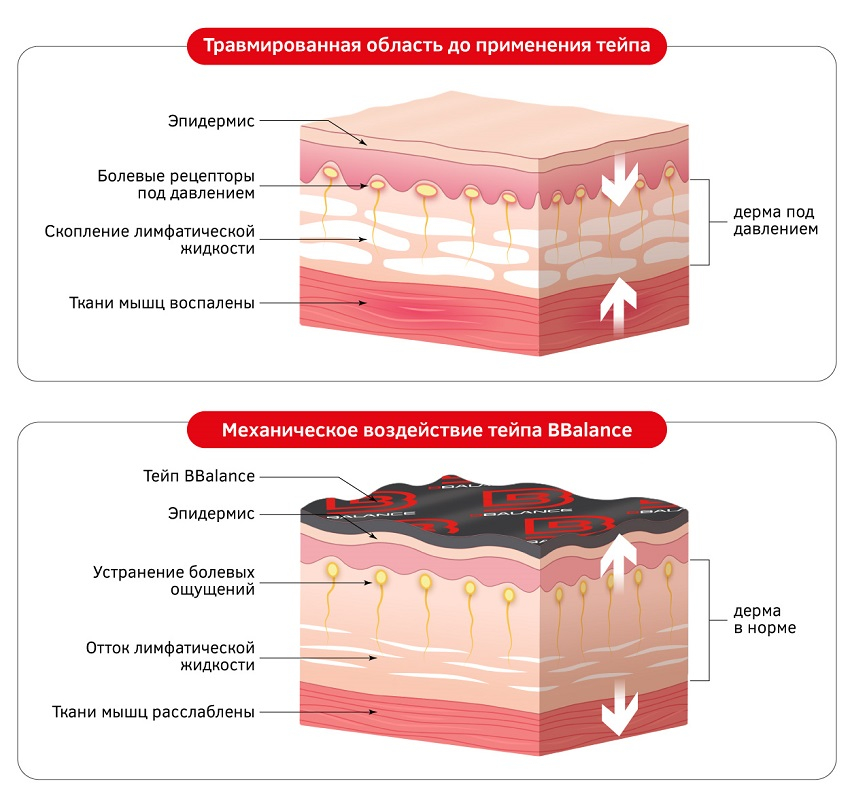 Кинезиотейп_2